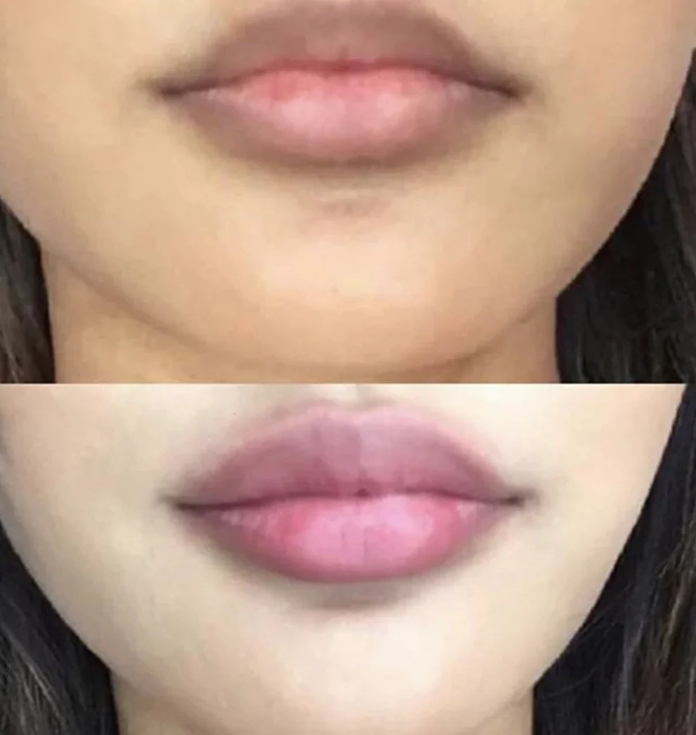 Lip Plumper